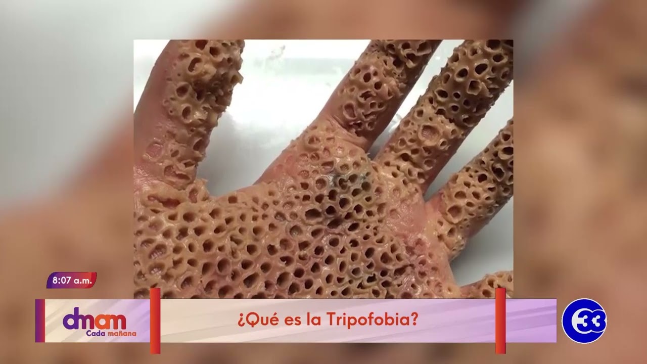 que es la tripofobia en humanos