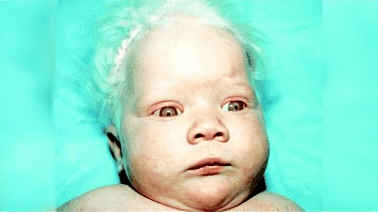 que pasa si dos hermanos tienen un hijo